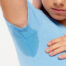 BOTOX® Treatment for Hyperhidrosis
