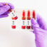 Vitamin B12 Injections: Boost Your Energy and Vitality
