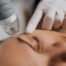 RF Microneedling: Unlock Your Skin’s Full Potential