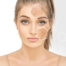 LASER SUN SPOT/ SKIN TAG REMOVAL